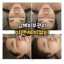 김해피부관리 삼안동 미앤제이뷰티 얼굴관리 후기