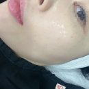 스킨모아 | 양주옥정 모아왁싱 세라링후기 스킨플래닝 자극없이 순한 세라링