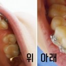 선이고운연세치과 네이버블로그