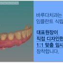 이-아트기공소 네이버블로그