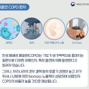 [만성폐쇄성폐질환] [생활요법] 꾸준한 치료와 생활습관 개선 통해 증상 완화하고 삶의 질 향상 가능
