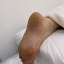 바미네일레푸스용인 | 충주내성발톱 발각질 관리 만족 후기 바미네일 레푸스 충주연수점