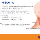 제 25강 귀 질환(중이염, 이명), 편도선염 이미지