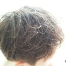 아론세라믹 이미지