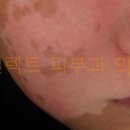 셀렉트피부과의원 이미지