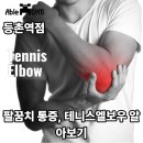 (주)네트파트너 | [등촌역헬스장]팔꿈치 통증, 테니스엘보우 알아보기