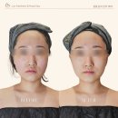 린(Lyn)에스테틱 | 잠실피부관리 린에스테틱&헤드스파 송파문정점 소개해요.