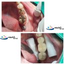 태양 치과기공소 이미지