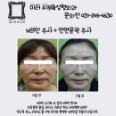 미러피부과성형외과 네이버블로그