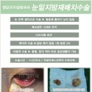 COZY 멍 이미지