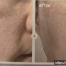 하로스파 이미지