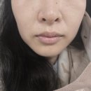 휴먼메디(주) | 동성로피부관리샵 아침부터 손님 많은 데자뷰메디스킨 대구점