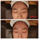 내안에 | 수내동피부관리 분당에스테틱 내안에 힐링스파 VVS무결점관리 후기