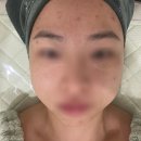 신목화장 | 탕정 피부관리 모이라이뷰티 파워건성피부 후기