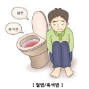 대장용종-아산병원제공 이미지