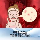 서울류마내과의원 | 서울 도봉구 류마내과의원에서 설명하는 약물로 치료하는 자가면역질환의 종류