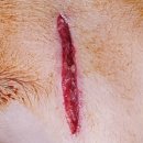 나노성형외과의원 | 아이 이마 찢어져서 동탄성형외과 다녀온 이야기 ㅠㅠ