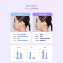 부산 리프팅 하우스 | ​부산미니리프팅후기 부드러인 라인으로