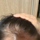 엄마의집 효도급식소 | 엄마의 흰머리 고민 해결! 쉐이킷 퍼머넌트 헤어 컬러로 효도 성공한 후기