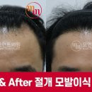 모먼트의원 이미지