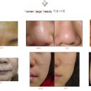 휴먼테카 이미지