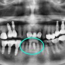 찬스플란트치과의원 이미지