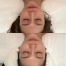 11590-나142-1 | ［ 서초 / 방배 ] 반포 서래마을 스파수이 호텔급 프리미엄 스파 피부관리 후기