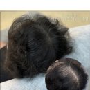 촘촘 스칼프 이미지