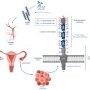 Re: 76세 여성 난소암 10년전 수술.. 1개월전 폐, 복막으로 전이상태... 치료계획 이미지