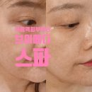 라움메디 | 부평역피부관리 추천 브이메디스파에서 MTS 엑소좀 관리 후기