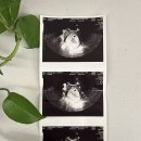 한마음산부인과의원 | 임테기 두 줄 보고 나서 뭐부터 하나요? 임신 확인 후 꼭 해야 할 일들 리스트 (찐 경험 바탕으로 작성)