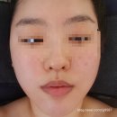나나리슈퍼 | 충북혁신도시 피부관리 윤곽관리 전문 프리미엄 에스테틱 브랜드 [에스테티아 충북혁신1호점]