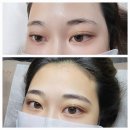 포천일동403 | 전곡 일동 동두천 송우리 눈썹문신 추천 찾는분들 주목!