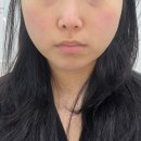 3415 | 대전시청역 피부샵 에스테티아 대전타임월드점 윤곽관리 받고 얼굴라인 정리