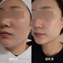 대구피부관리 추천, 동성로 피부관리샵 데자뷰메디스킨 후기