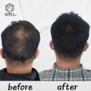 미쁘다 | 청주두피문신 자연스럽게 달라진 '미쁘다' 후기