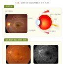 당뇨신문
