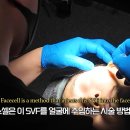 청담셀의원 티스토리
