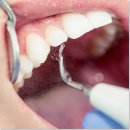 첨단퍼스트치과의원 이미지