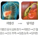 설마 했는데..알레르기 비염 그냥 놔두니, 이 병까지 데려왔다 이미지