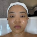 첨단과기로208번길 | 첨단피부관리 한별스킨바디에서 온다웨이브 받고 온 후기 턱선 정리 추천