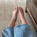 합동플라스틱 | 복숭아뼈 골절 수술 과정 및 비용 회복 후기