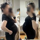 정안산부인과의원 | 31주 ~ 35주 임산부 곽생로 산후조리원 산전마사지 김경애떡방 갈비뼈실금 후기