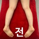 온더뷰티 | 내서피부관리_ 더앤뷰티 ) 전신뱀부테라피받고 온 후기