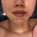 다솔메디칼 | [마리앙에스테틱] 영등포 에스테틱 윤곽관리 솔직한 후기!