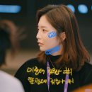 D-7 | 웨딩 D-7, 리쥬란 맞고 얼굴 망함 후기 공개(엠보,멍)