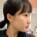 동탄 피부과 온다리프팅 80kj &amp; 스킨보톡스 &amp; 재생관리 후기 🤍