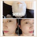 날로날로 | 대구 송현동 피부관리 받고 온 날로뷰티 후기