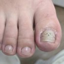 레푸스 감삼점&에이레네 이미지