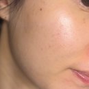 아크리스 | 트러블 때문에 고민인 분들을 위한 폼클렌징 추천! "아토뮤 아크리스 세럼+폼클렌저" 트러블 관리세트 후기